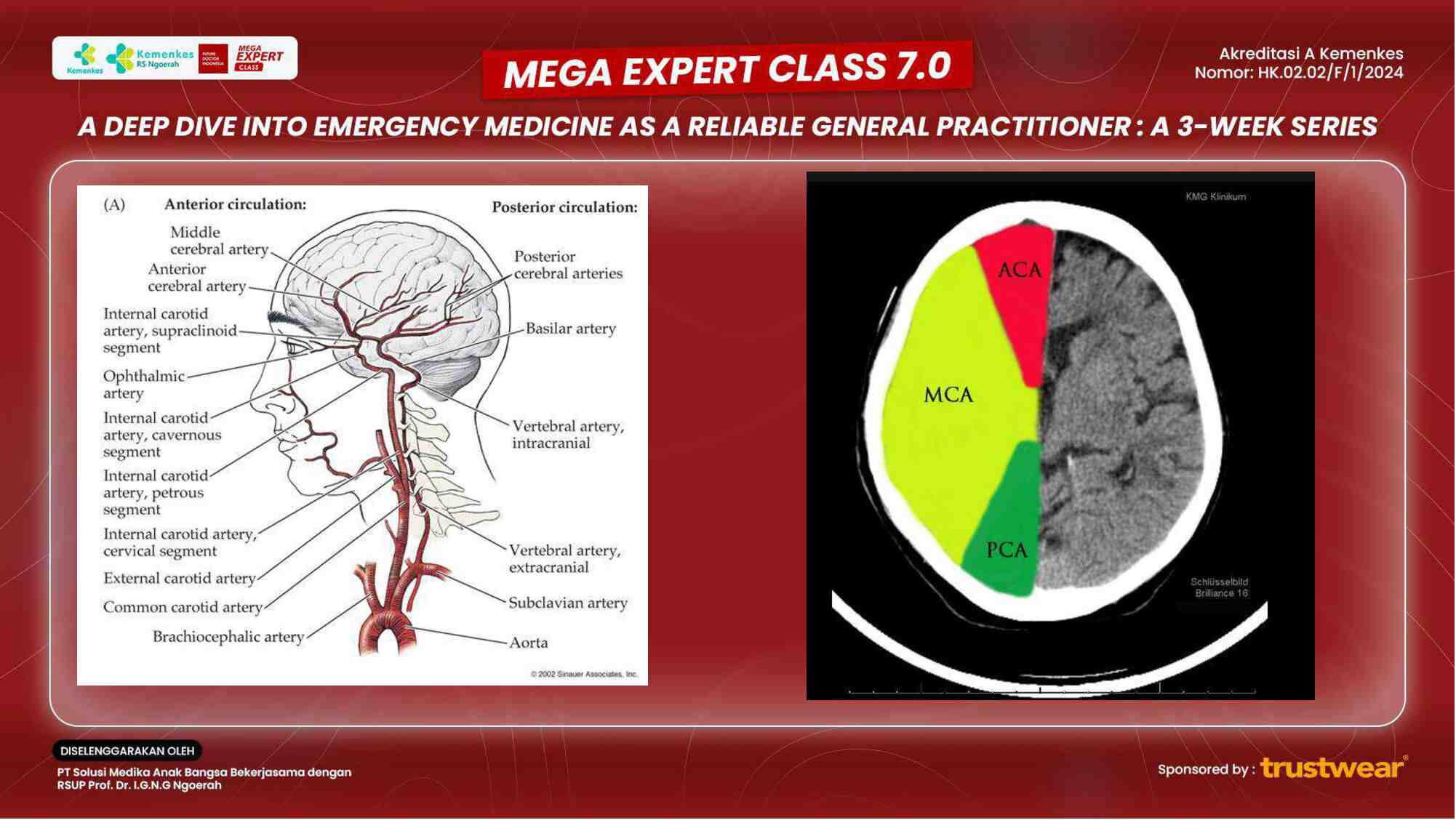 [week-2]-stroke-management-ischemic-vs-hemorrhagic-–-key-interventions-for-better-outcomes-195